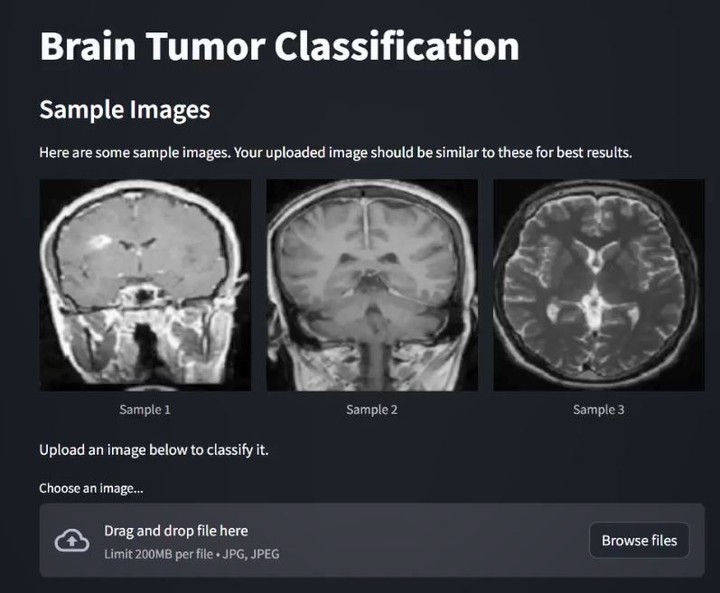 تصنيف أورام الدماغ باستخدام بيانات MRI