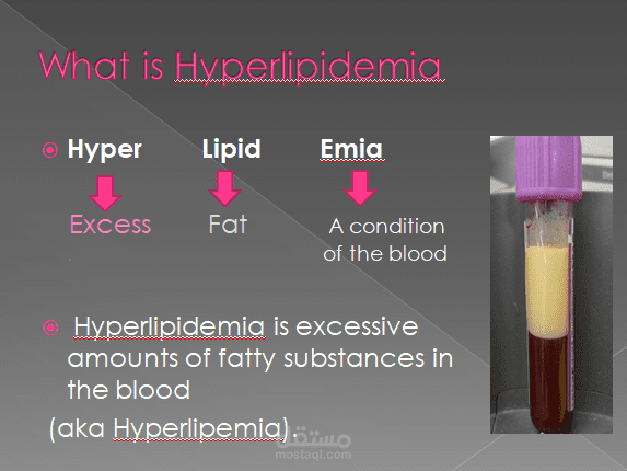 عرض تقديمي لمرض زيادة الدهون بالدم