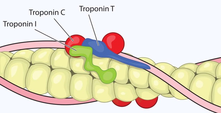 Systematic review on troponin