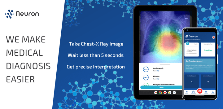 Neuron Chest Xray Classifier