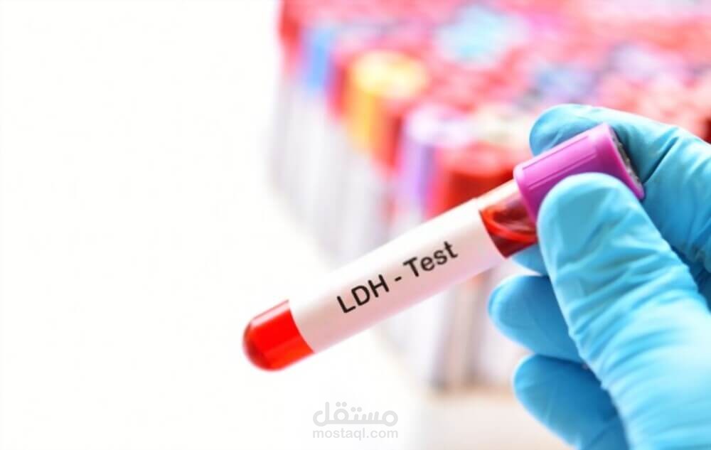 مقال طبي غير منسوخ عن "تحليل ldh وعلاقته بكورونا والسرطان"