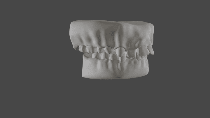 تحويل صور اسنان مريض من 2D الى مجسم 3D